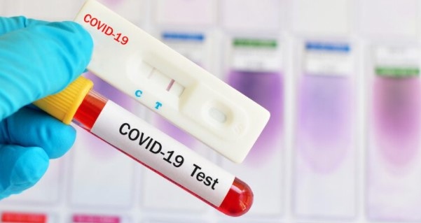 2370 са новите случаи на коронавирус у нас според обновенните